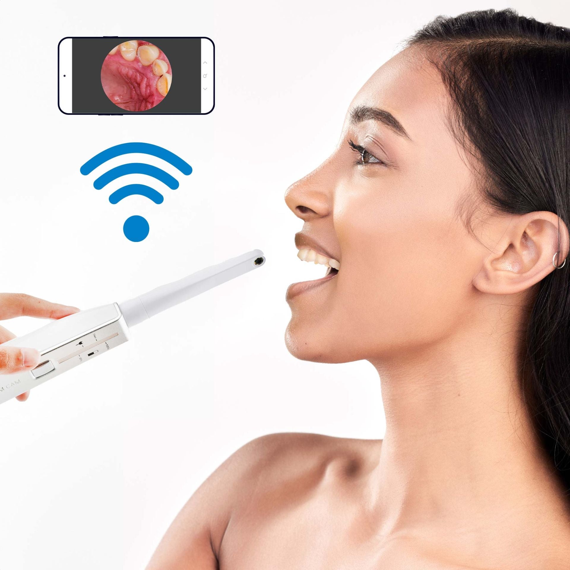 emmi-dent-platinumcam-dentalkamera-aufsatz-f-r-platinumcam-mit-app-verbindung image 5