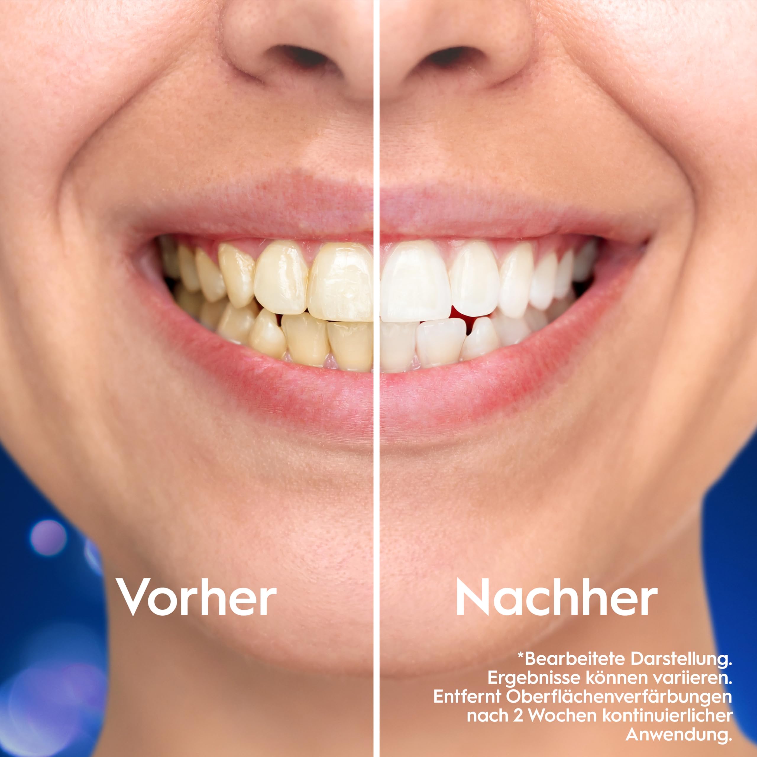 oral-b-3d-white-clinical-intensive-whitening-zahnpasta-75-ml image 3